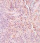SQSTM1 Antibody